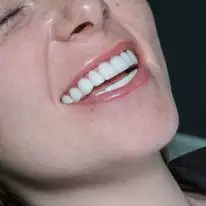 Slider image (9) Turkiye Dental